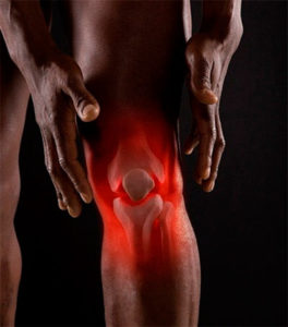 ревматология и боль в колене