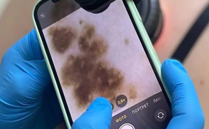 4 лютого — Всесвітній день боротьби проти раку🎗️