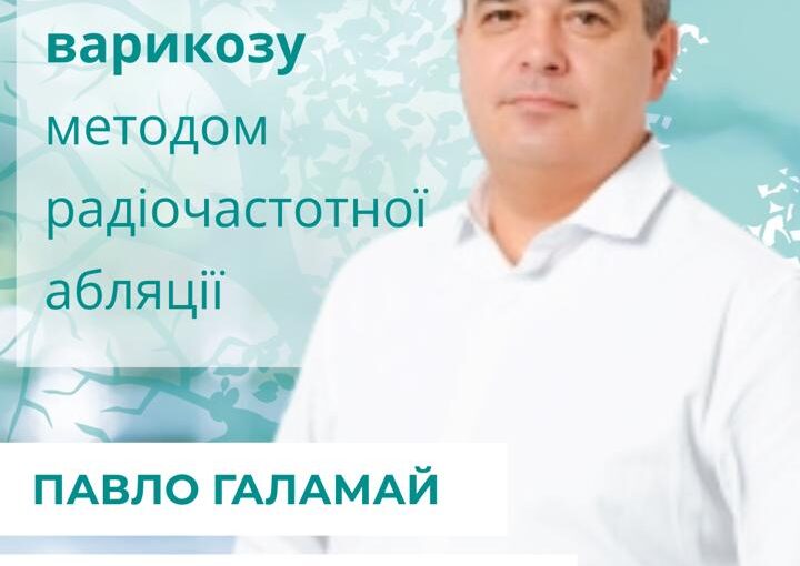 Варикоз можна вилікувати безболісно та без реабілітації