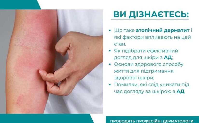 Запрошуємо на семінар: що таке атопічний дерматит, як правильно доглядати за шкірою?Участь безкоштовна