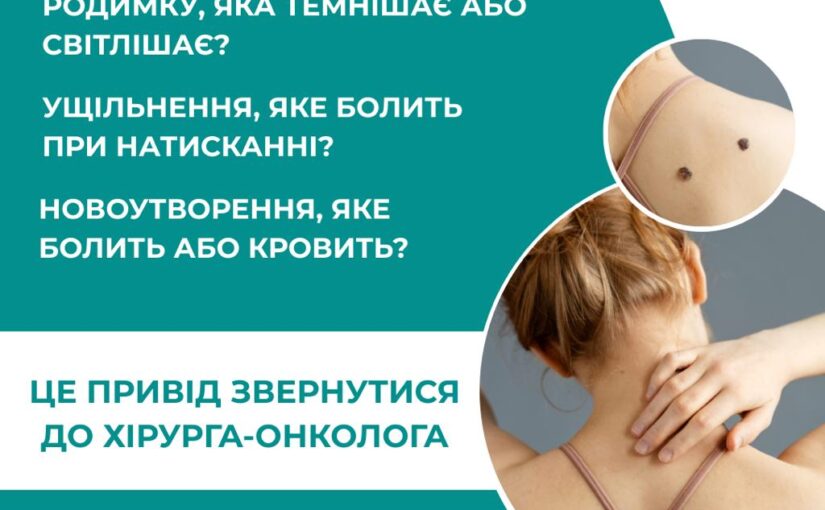 Іноді ми помічаємо зміни родимки, але відкладаємо: «потім», «як буде час», «може саме пройде»