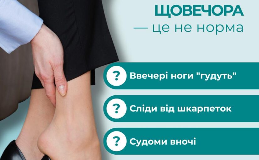 Ваші ноги не винні, що зараз зима. Чому саме зараз вени «кричать» про допомогу?